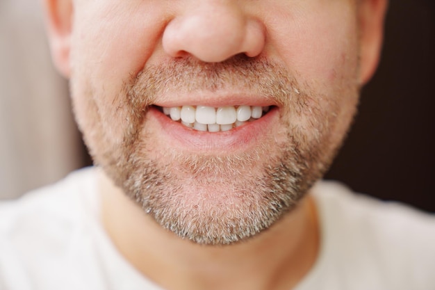 Gros plan sur la bouche de l39homme avec des sourires de chaume et montre des dents blanches