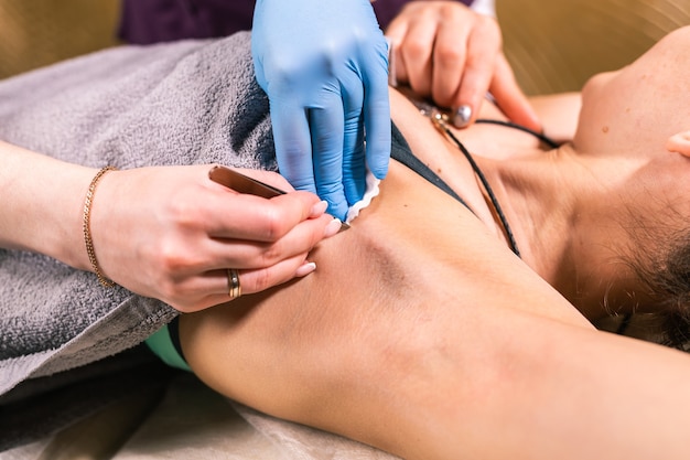 Gros plan sur l'épilation des aisselles avec une pince à épiler. Épilation féminine. Cosmétologie et institut de beauté