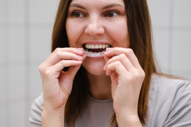 Gros plan d'une femme devant un miroir dans la salle de bain mettant des gouttières ou des accolades en plastique invisible Sourire beau et sain