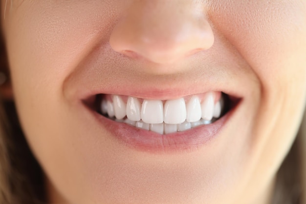 Gros plan d'une femme montrant des dents blanches lisses et saines concept d'hygiène et de soins dentaires