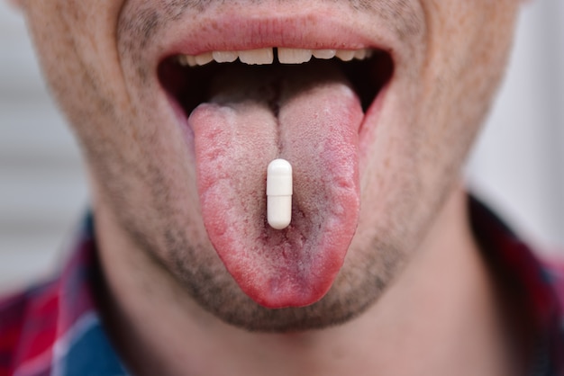 Gros plan de l'homme avec la bouche ouverte a une capsule blanche sur la langue