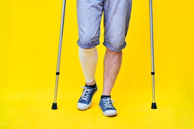 Gros plan des jambes d'un homme portant des shorts et des béquilles, avec une jambe bandée