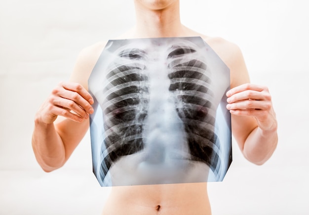 Gros plan d'un jeune homme tenant une radiographie des poumons sur la poitrine