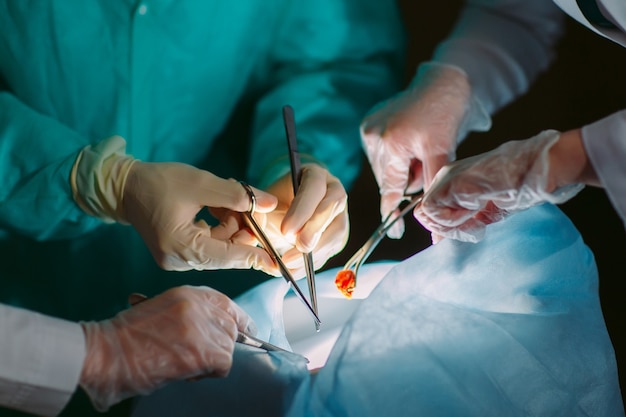 Gros plan sur les mains des chirurgiens tenant des instruments médicaux. Le chirurgien fait une opération.