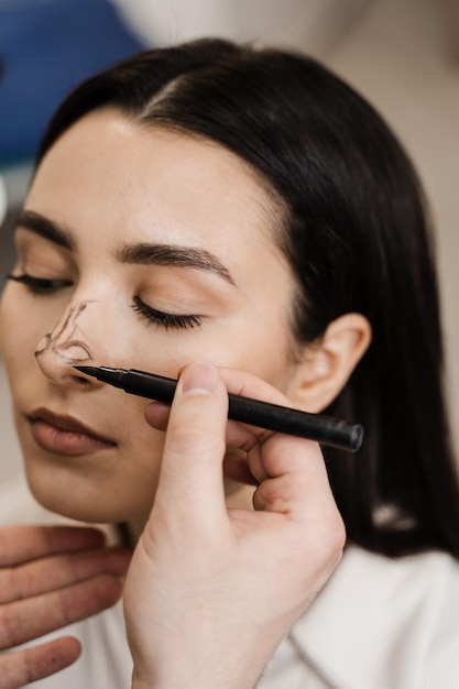 Gros plan sur le nez de balisage de rhinoplastie La rhinoplastie remodèle la chirurgie du nez pour changer l'apparence du nez et améliorer la respiration Le médecin ORL dessine des lignes de marquage sur le nez avant la chirurgie de rhinoplastie