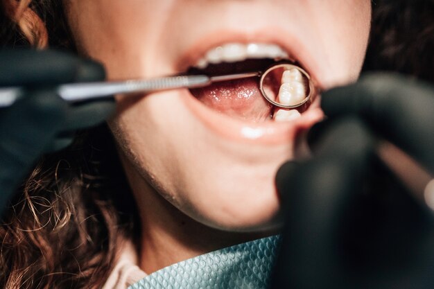 Photo gros plan, patient, dentiste, vérification, dents