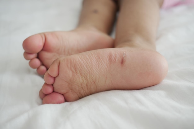 Gros plan des pieds d'enfant secs sur le lit