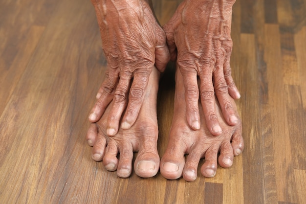 Photo gros plan sur les pieds des femmes âgées et massage des mains sur la tache de blessure