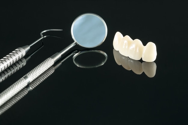 Gros plan / prosthodontie ou prothèse / couronne dentaire et matériel de dentisterie implantaire de bridge et modèle de restauration express fix.