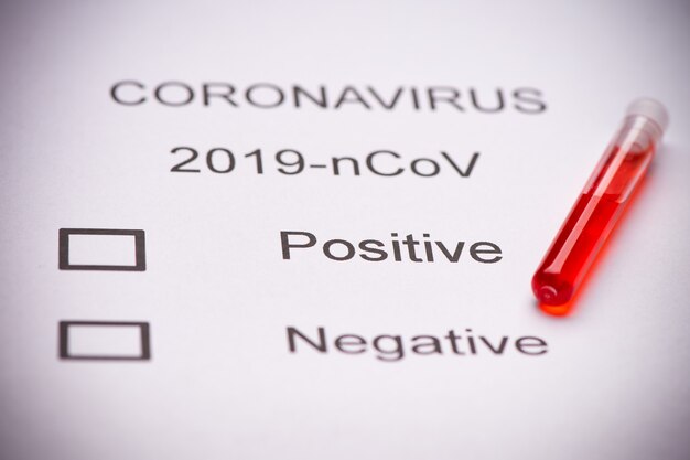Gros plan sur un tube à essai de coronavirus du syndrome respiratoire du Moyen-Orient contenant du MERS-CoV