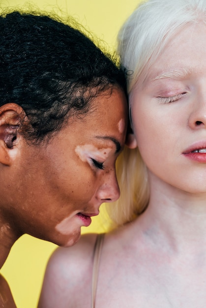 Photo groupe de femmes multiethniques avec différents types de peau posant ensemble en studio