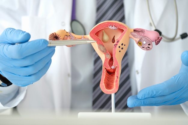 Photo gynécologue homme montrant des maladies féminines avec un stylo sur un modèle artificiel en plastique d'utérus et d'ovaires ...