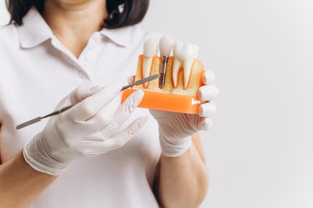 Heureuse femme médecin dentiste montrant une maquette d'implants