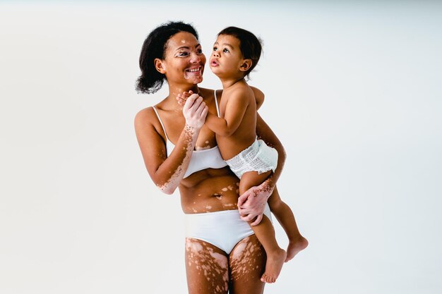 Heureuse femme noire atteinte de vitiligo tenant son bébé sur fond coloré