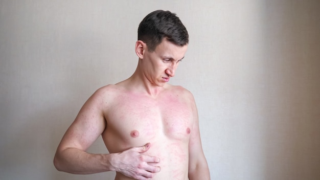Un homme contrarié se gratte la poitrine et souffre de démangeaisons gênantes