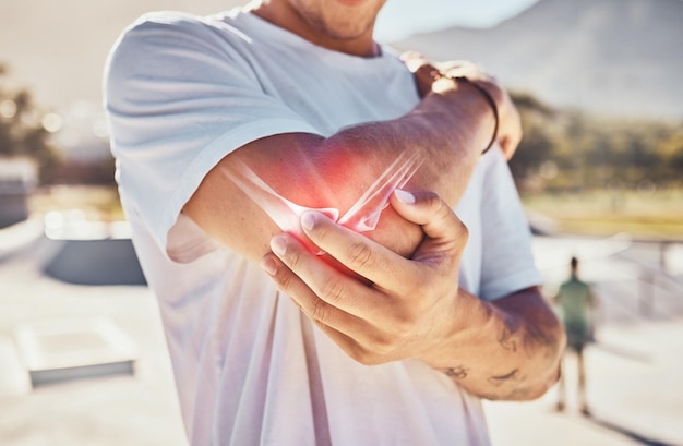 Homme douleur articulaire et arthrite du coude en gros plan extérieur sous le soleil d'été avec des bras de massage Os du bras cassé et un gars dans un parc urbain dans une ville ou une ville métropolitaine avec une thérapie physique avec les mains en zoom