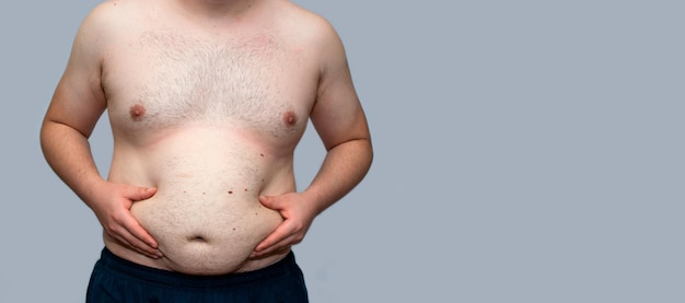 homme obèse tenant son estomac