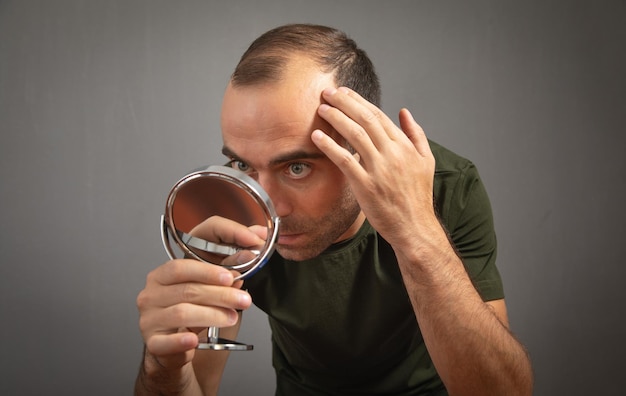 Homme regardant un miroir Concept de perte de cheveux