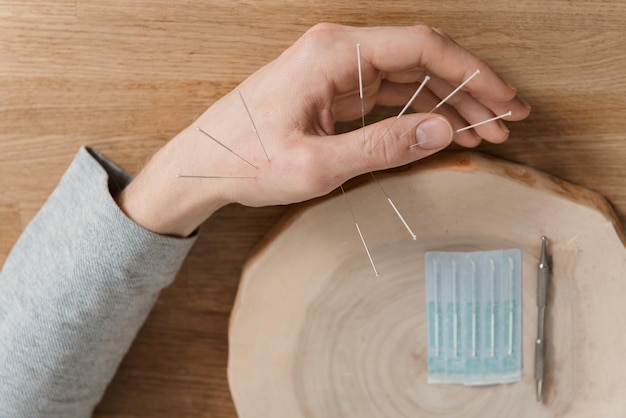 Homme utilisant un traitement d'acupuncture pour soulager la douleur