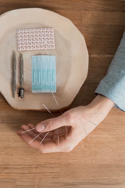 Homme utilisant un traitement d'acupuncture pour soulager la douleur