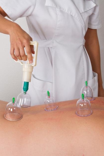 homme avec des ventouses sur le dos au spa de santé