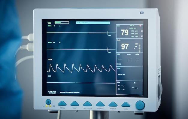 Hôpital de soins de santé et moniteur ou écran d'électrocardiogramme Outil médical équipement ecg et dispositif de fréquence cardiaque pour mesurer le pouls et l'activité électrique du cœur pour la santé cardiovasculaire