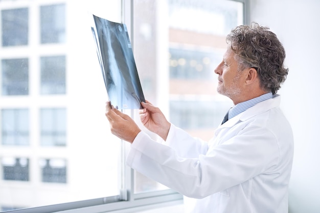 Il a obtenu les informations privilégiées sur votre santé Photo d'un médecin mature examinant une radiographie dans son bureau