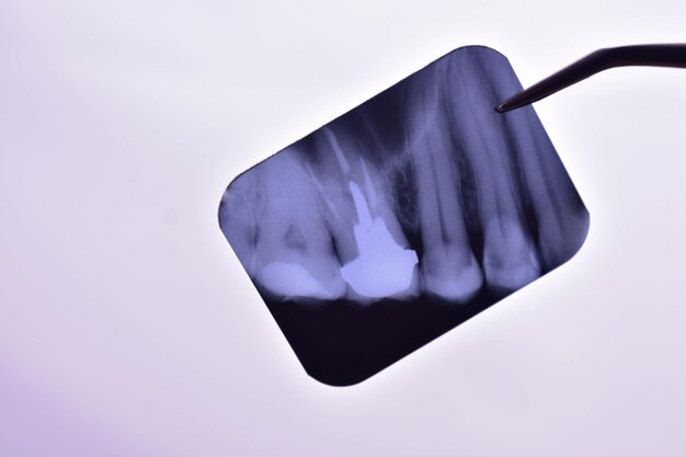 Photo une image radiographique de dents dans les mains d'un médecin