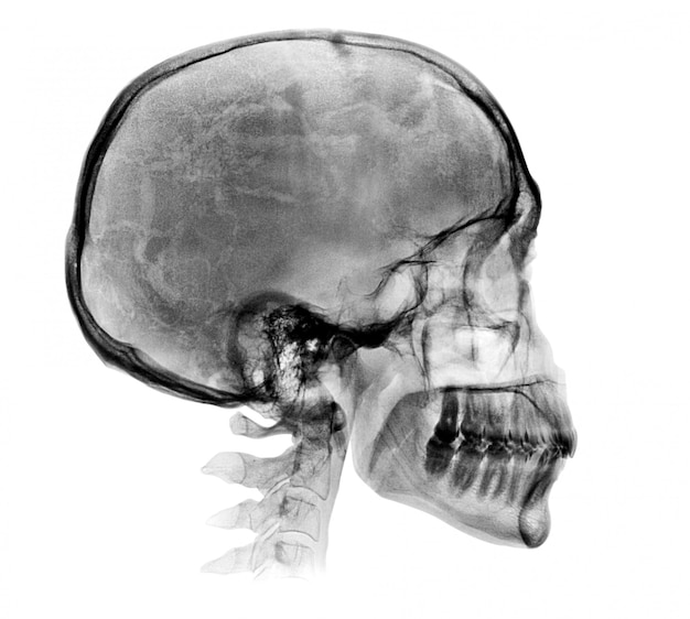 Image radiographique détaillée du crâne humain