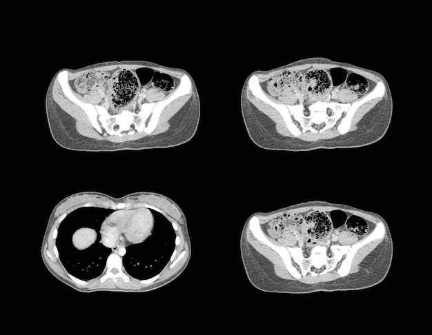 Images professionnelles CT Scan et IRM Abdomen