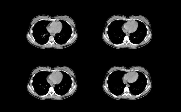 Images professionnelles CT Scan et IRM Abdomen