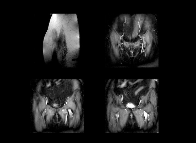 Images professionnelles de tomodensitométrie et d'IRM