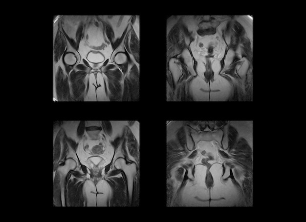 Images professionnelles de tomodensitométrie et d'IRM