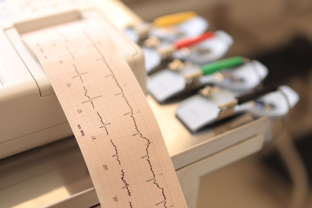 Photo imprimer des enregistrements cardiaques avec un électrocardiogramme