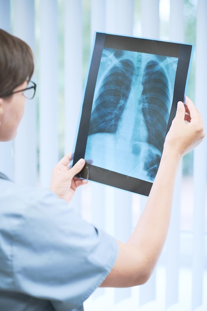 Indiquant la présence d'une pneumonie sur l'image radiographique des poumons