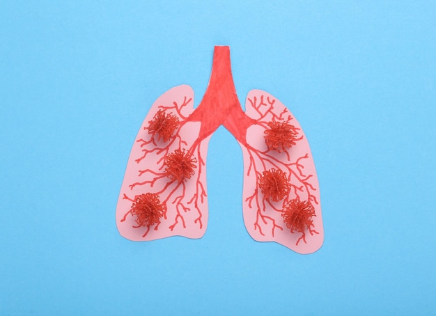 Infection pulmonaire par pneumonie Covid-19 Poumons avec des molécules de virus sur un fond bleu
