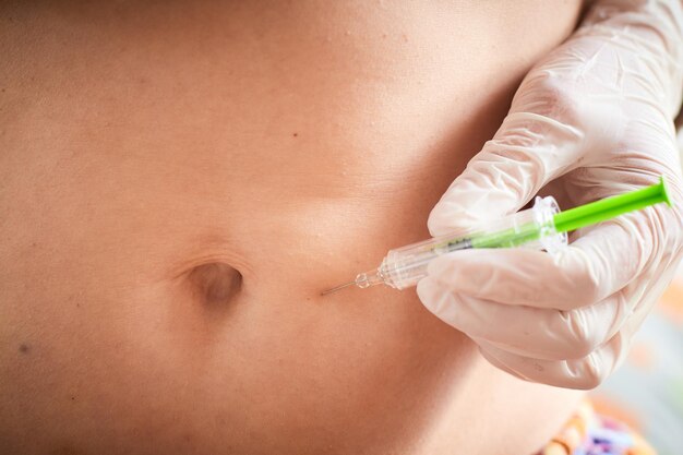 Photo injection d' un anticoagulant près du nombril chez les femmes souffrant de thrombophilie pour prévenir l' avortement