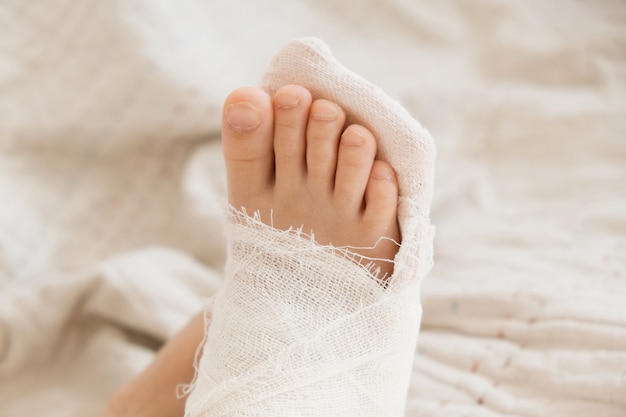 Jambe cassée. Gros plan du plâtre sur les pieds. exercices pour réparer et renforcer les muscles. dommages aux os. soins médicaux d'un chirurgien dans la salle d'urgence