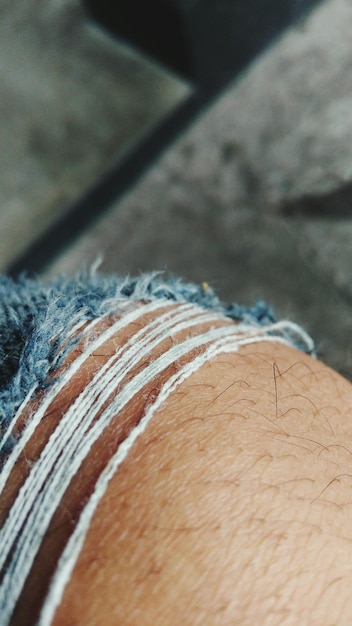 Photo une jambe coupée portant un jean déchiré