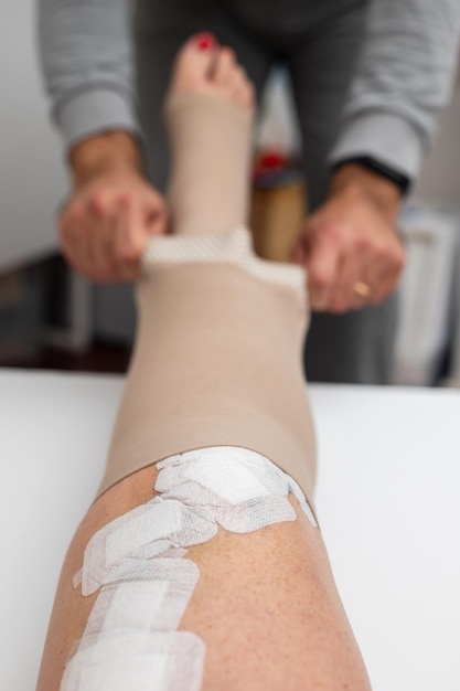 Jambe avec patchs après traitement des varices