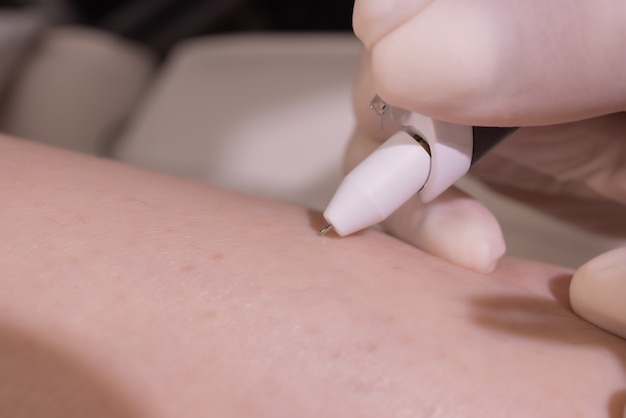 Jambes féminines sur drap violet pendant l'épilation par une esthéticienne professionnelle en gants. Spa, industrie de la beauté, traitement en clinique, électrolyse.