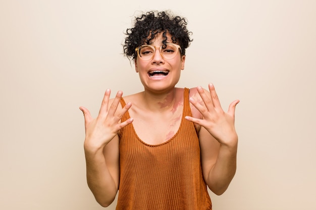 Jeune femme afro-américaine avec la marque de naissance de peau crier de rage.