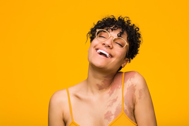 Jeune femme afro-américaine avec marque de naissance de la peau détendue et heureuse de rire, cou tendu montrant les dents.