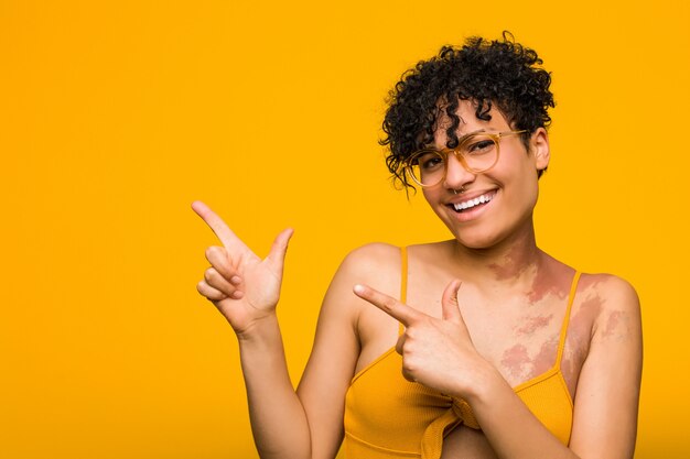 Jeune femme afro-américaine avec une marque de naissance de peau pointant avec des index, exprimant une excitation et un désir.