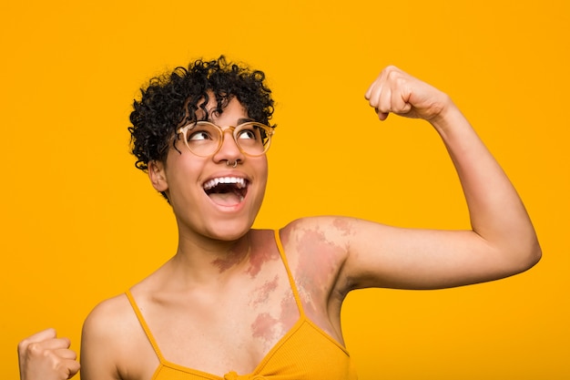 Jeune femme afro-américaine avec peau marque de naissance levant le poing après une victoire, concept gagnant.