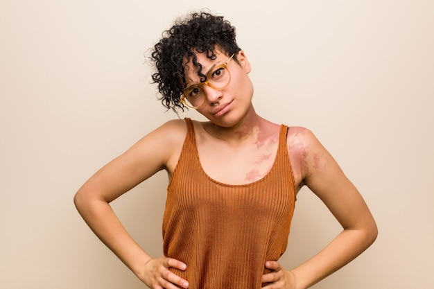 Photo jeune femme afro-américaine avec la peau naissance marque étirement des bras, position détendue.