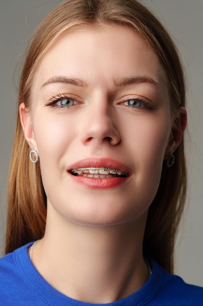 Photo une jeune femme avec des appareils dentaires en gros plan