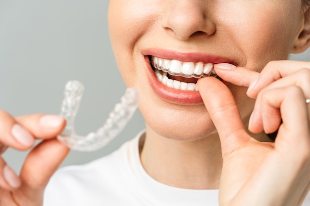 Une jeune femme fait une procédure de blanchiment des dents à domicile avec un plateau de blanchiment avec du gel