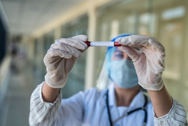 Jeune femme médecin portant un écran facial tenant un tube à essai avec un échantillon de sang avec un résultat positif Covid-19