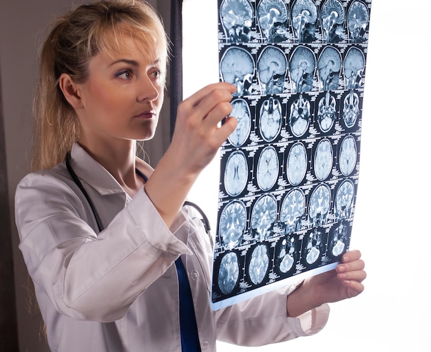 Jeune femme médecin professionnelle en blouse blanche tenant l'irm du cerveau humain et le regardant